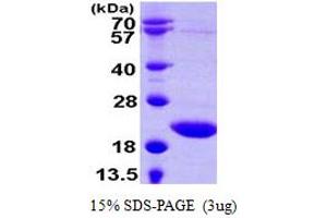 SDS-PAGE (SDS) image for tRNA Splicing Endonuclease 15 Homolog (TSEN15) (AA 1-171) protein (His tag) (ABIN667915) (TSEN15 Protein (AA 1-171) (His tag))