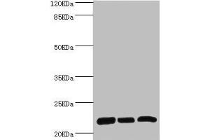 Western blot All lanes: RPL9 antibody at 0. (RPL9 antibody  (AA 1-192))