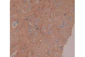 IHC-P analysis of Rat Tissue, with DAB staining. (Coagulation Factor IX antibody  (AA 61-263))