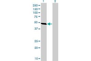 Western Blot analysis of C9orf98 expression in transfected 293T cell line by C9orf98 monoclonal antibody (M01), clone 3B8. (AK8 antibody  (AA 381-479))