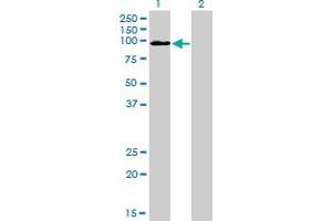 Western Blot analysis of MCC expression in transfected 293T cell line by MCC monoclonal antibody (M01), clone 1A7. (MCC antibody  (AA 31-130))
