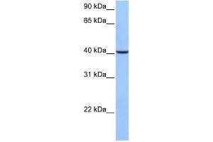 AGBL5 antibody used at 1 ug/ml to detect target protein.