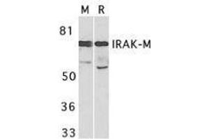 Western Blotting (WB) image for anti-Interleukin-1 Receptor-Associated Kinase 3 (IRAK3) (C-Term) antibody (ABIN2475133) (IRAK3 antibody  (C-Term))