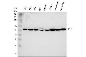 Western blot analysis of DLD using anti-DLD antibody (ABIN3043561).