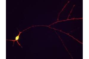 Immunofluorescence of cultured rat hippocampal neurons showing staining of tau in red along the neuronal processes. (MAPT antibody)