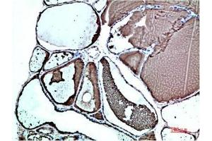 Immunohistochemical analysis of paraffin-embedded Human Thyroid Tissue using TTR Mouse mAb diluted at 1:200. (TTR antibody)