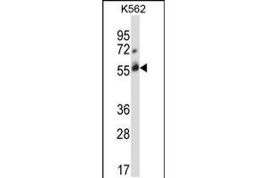 Western blot analysis in K562 cell line lysates (35ug/lane). (CBLC antibody  (C-Term))