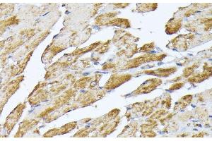 Immunohistochemistry of paraffin-embedded Mouse heart using SLC25A5 Polyclonal Antibody at dilution of 1:100 (40x lens).