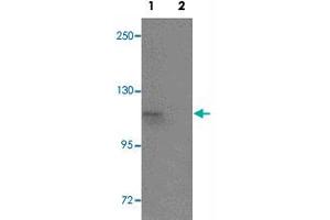 Western blot analysis of SCUBE1 in Daudi cell lysate with SCUBE1 polyclonal antibody  at 1 ug/mL in (1) the absence and (2) the presence of blocking peptide. (SCUBE1 antibody  (Internal Region))