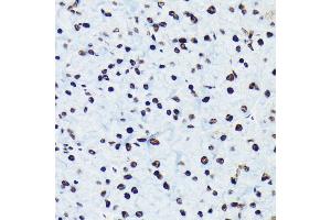 Immunohistochemistry (IHC) image for anti-Retinoblastoma 1 (RB1) (pSer780) antibody (ABIN7269936)