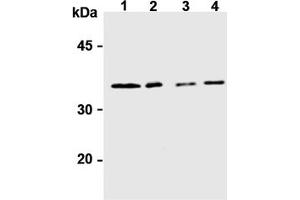 Western Blotting (WB) image for anti-Syntaxin 6 (STX6) antibody (ABIN492572) (Syntaxin 6 antibody)