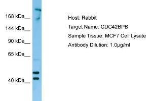 Western Blotting (WB) image for anti-CDC42 Binding Protein Kinase beta (DMPK-Like) (CDC42BPB) (C-Term) antibody (ABIN970360) (CDC42BPB antibody  (C-Term))