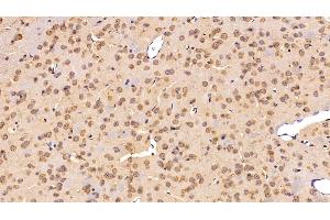 Detection of C3 Convertase in Mouse Cerebrum Tissue using Polyclonal Antibody to Complement C3 Convertase (C3 Convertase) (Complement C3 Convertase antibody)