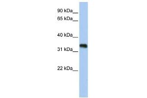 C6ORF140 antibody used at 1 ug/ml to detect target protein.