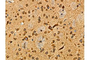 ABIN6265513 and ABIN6276479 at 1/100 staining Mouse brain tissue by IHC-P. (TDGF1 antibody  (Internal Region))