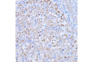 Immunohistochemistry of paraffin-embedded rat ovary using MT-ND1 antibody (ABIN7268598) at dilution of 1:100 (40x lens). (MT-ND1 antibody)