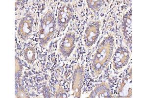 IHC analysis of IFIT5 using anti-IFIT5 antibody (ABIN7600752). (IFIT5 antibody  (AA 23-439))