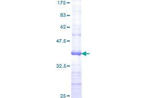 MSH6 Protein (AA 931-1030) (GST tag)