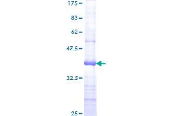 MSH6 Protein (AA 931-1030) (GST tag)