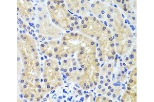 Immunohistochemistry of paraffin-embedded Mouse kidney using INADL Polyclonal Antibody at dilution of 1:100 (40x lens). (PATJ antibody)