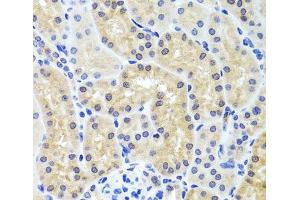Immunohistochemistry of paraffin-embedded Mouse kidney using INADL Polyclonal Antibody at dilution of 1:100 (40x lens).