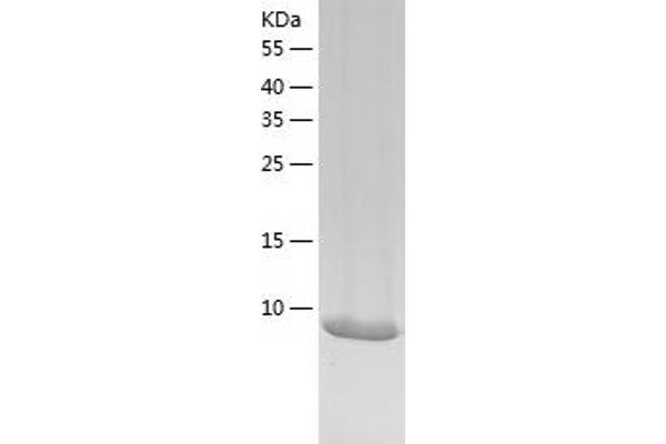 EIF4EBP3 Protein (AA 1-100) (His tag)