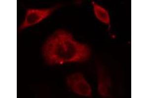 ABIN6274657 staining Hela cells by IF/ICC. (Cytochrome P450 3A4, 3A5 antibody)
