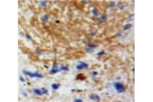 IHC-P analysis of Brain tissue, with DAB staining. (Neurotrophin 3 antibody  (AA 130-255))