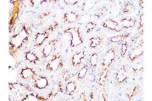 Immunohistochemistry of paraffin-embedded mouse kidney using Clathrin heavy chain Rabbit mAb (ABIN7266404) at dilution of 1:100 (40x lens). (Clathrin Heavy Chain (CLTC) antibody)