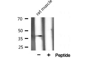 XRCC3 antibody  (N-Term)