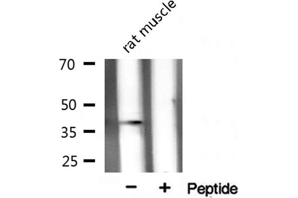 XRCC3 antibody  (N-Term)