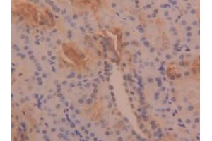 Detection of TPS in Human Kidney Tissue using Polyclonal Antibody to Tryptase (TPS) (TPSAB1 antibody  (AA 161-262))