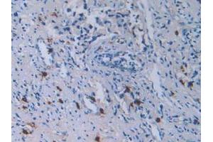 Figure. (TPSAB1 antibody  (AA 161-262))