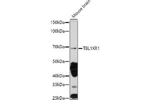 Western blot analysis of extracts of Mouse brain, using TBL1XR1 antibody (ABIN6132717, ABIN6148893, ABIN6148895 and ABIN6217436) at 1:1000 dilution. (TBL1XR1 antibody  (AA 1-180))