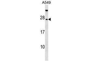 TBC1D28 Antibody (Center) western blot analysis in A549 cell line lysates (35µg/lane). (TBC1D28 antibody  (Middle Region))