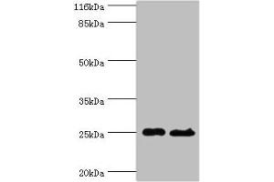 Western blot All lanes: Calcineurin B homologous protein 3 antibody at 2 μg/mL Lane 1: Hela whole cell lysate Lane 2: Mouse brain tissue Secondary Goat polyclonal to rabbit at 1/10000 dilution Predicted band size: 25, 19, 22 kDa Observed band size: 25 kDa (Tescalcin antibody  (AA 2-214))