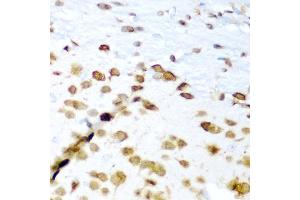 Immunohistochemistry of paraffin-embedded mouse brain using ELAVL3 antibody (ABIN5975823) at dilution of 1/200 (40x lens).