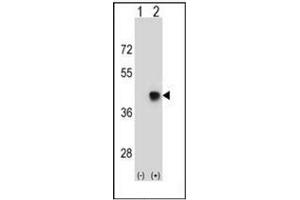 Western blot analysis of SPEM1 (arrow) using SPEM1 Antibody (Center) Cat. (SPEM1 antibody  (Middle Region))