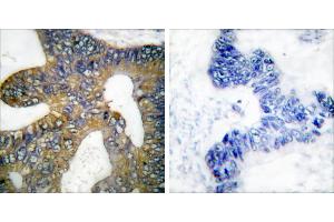 Peptide - +Immunohistochemical analysis of paraffin-embedded human colon carcinoma tissue using HSP105 antibody (#C0231).