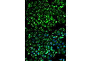 Immunofluorescence analysis of HeLa cell using TPSAB1 antibody. (TPSAB1 antibody  (AA 19-210))