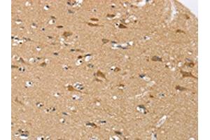 The image on the left is immunohistochemistry of paraffin-embedded Human brain tissue using ABIN7192337(SEZ6L Antibody) at dilution 1/30, on the right is treated with synthetic peptide. (SEZ6L antibody)
