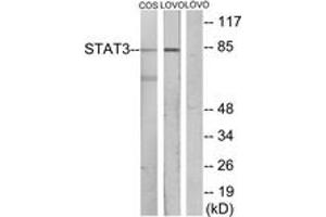 Western blot analysis of extracts from LOVO/COS7 cells, using STAT3 Antibody. (STAT3 antibody  (AA 656-705))
