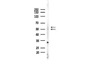 anti-Arylsulfatase A (ARSA) (Internal Region) antibody