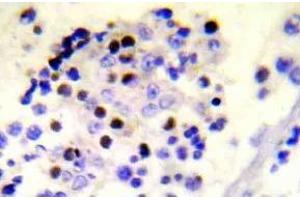 Immunohistochemistry (IHC) analyzes of p-Histone H2A. (H2AFX antibody  (pSer139))