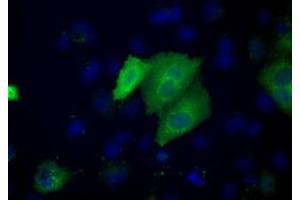 Image no. 3 for anti-Acetyl-CoA Acetyltransferase 2 (ACAT2) antibody (ABIN1496400) (ACAT2 antibody)