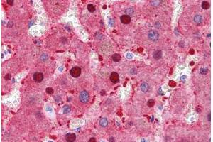Human Liver: Formalin-Fixed, Paraffin-Embedded (FFPE) (FAH antibody  (N-Term))