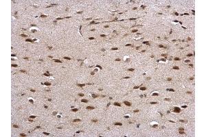 IHC-P Image PRP antibody detects PRP protein at nucleus on mouse middle brain by immunohistochemical analysis. (PRNP antibody)