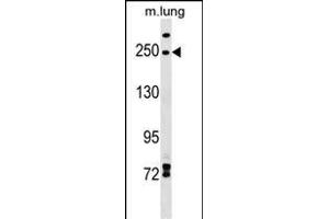 INF2 Antibody (Center) (ABIN1538520 and ABIN2849238) western blot analysis in mouse lung tissue lysates (35 μg/lane).