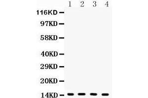 Western Blotting (WB) image for anti-Fatty Acid Binding Protein 4, Adipocyte (FABP4) (AA 10-40), (N-Term) antibody (ABIN3043827)