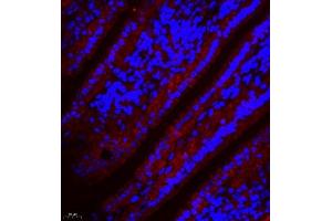 Immunofluorescence of paraffin embedded mouse small intestine using SLC7A8 (ABIN7074503) at dilution of 1:300 (400x lens) (LAT2 antibody)